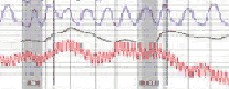 Anaheim polygraph for infidelity